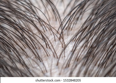 Super Macro Close Up Clean Hair And Clean Scalp