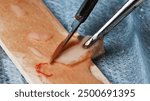 the surgeon cuts a soft tissue flap before grafting into the gum