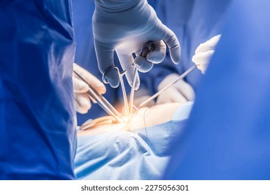 Surgeon or doctor in blue uniform did surgery in surgical hospital with orange light effect and blur background. Surgeon and nurse use medical instrument or equipment in operating room.People working.