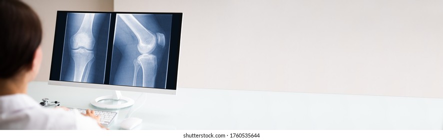 Surgeon Doctor Looking At Knee Bone Xray