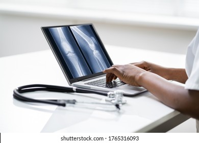 Surgeon Doctor Looking At Knee Xray Bone Scan Using Software Technology