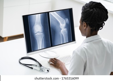 Surgeon Doctor Looking At Knee Xray Bone Scan Using Software Technology