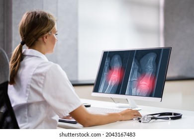 Surgeon Doctor Looking At Knee Xray Bone Scan Using Software Technology