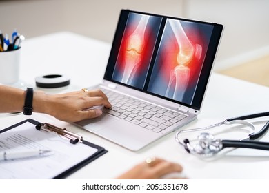 Surgeon Doctor Looking At Knee Xray Bone Scan Using Software Technology