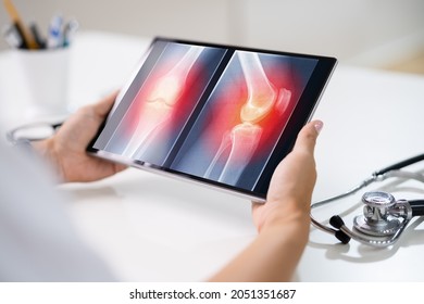 Surgeon Doctor Looking At Knee Xray Bone Scan Using Software Technology