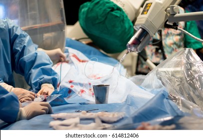Surgeon doctor on operate patient in surgery room.
