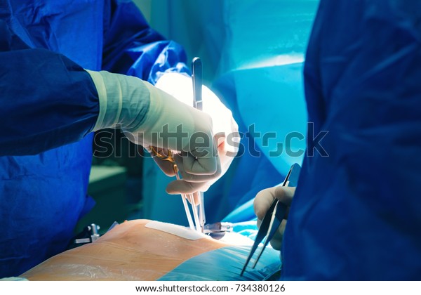 Surgeon doctor operating\
wearing special lamp lighting using clamps for open heart surgery\
intervention close-up, open cord surgery minimally invasive\
surgery