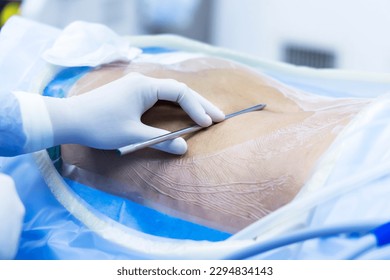 Surgeon or doctor use stainless medical probe to check the level of spine or vertebra before spinal surgery.Hand of people with glove on patient's back.Level checked by fluoroscopy.Operating room.