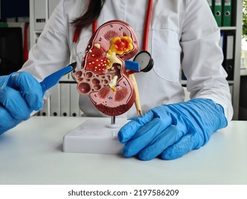 Surgeon In Glove Holds Scalpel And Anatomy Of Kidney. Operation Kidney Transplant Concept