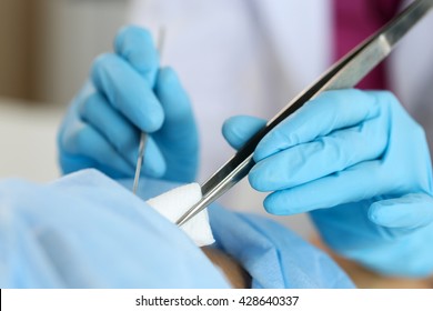 Surgeon hand hold scalpel and tweezers while cut and cure wound closeup. Resuscitation and or, injury heal, medic shop or store, saving patient, 911, surgery and emergency, put stitch concept