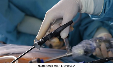 Surgeon Hands During Laparoscopic Surgery, Close-up 