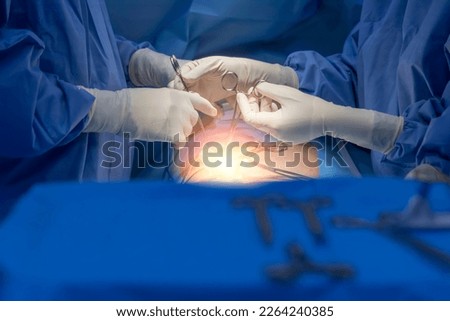 Surgeon or nurse pick up surgical instrument for surgeon inside operating room in hospital.Doctor in blue protective uniform doing surgery with light effect.Selective focus with blur background.