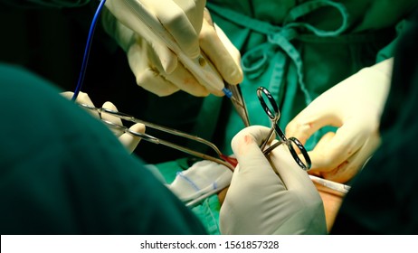 Surgeon Performing Inguinal Hernia Repair Hernioplasty Stock Photo ...