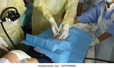 Surgeon Performing Percutaneous Endoscopic Gastrostomy With Abdominal Cannulation Under Local Anaesthetia