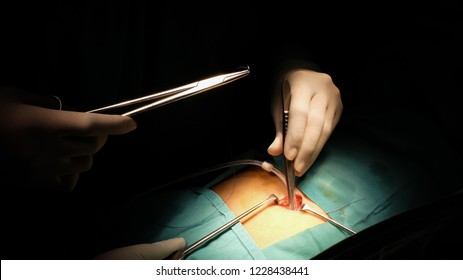 Surgeon Suturing The Tenkoff Catheter Under Aseptic Technique.