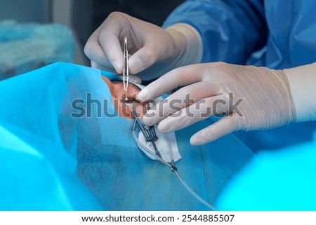 Surgeon Using Precision Forceps in Eye Surgery