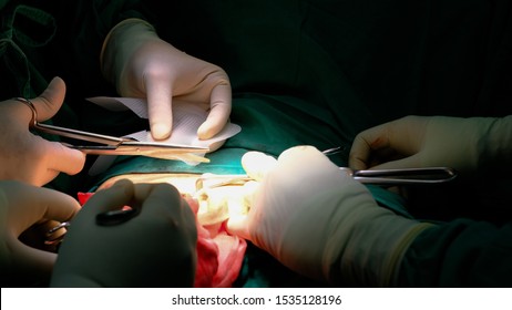 Surgeon Using Synthetic Mesh To Repair Hernia.