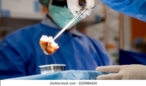 Surgeons Or Doctor Hands With Protective Glove Hold Sponge Holding A Sterilzed Gauze With Betadine Antiseptic Liquid For Skin To Clean Or Prep Wounds And Surgical Areas In Operation Room,Health Care,