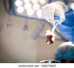 Surgeons Or Doctor Hands With Protective Glove Hold Sponge Holding A Sterilzed Gauze With Betadine Antiseptic Liquid For Skin To Clean Or Prep Wounds And Surgical Areas In Operation Room,Health Care,