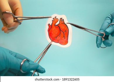 Surgeons ' Gloved Hands Hold Clamps With A Painted Human Heart. The Concept Of Organ Transplantation. Blue Background.