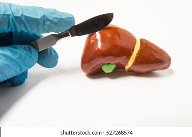Surgeon's hand in blue latex glove holding scalpel over anatomical figure of human liver. Concept that symbolizes process of surgery treatment of liver diseases such as cancer, hydatid disease ets.
