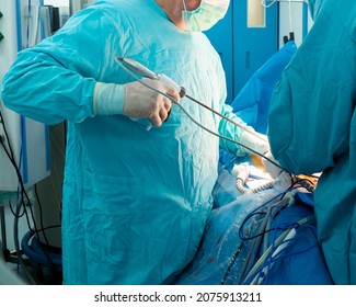 The surgeon's hand inserts the laparoscopic instrument through the trocar into the patient's body. Selective focus. Minimally invasive laparoscopic proctological surgery.