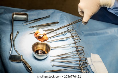 Surgeons Hands With Protective Glove Hold Sponge Holding A Sterilzed Gauze With Betadine Antiseptic Liquid For Skin To Clean Or Prep Wounds And Surgical Areas In Operation Room With Medical Equipment.