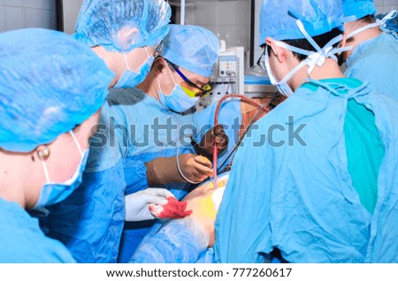Surgeons nurse doctors do the operation, plastic surgery, transplantation, medicine operating room