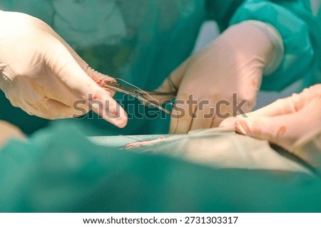 Surgeons Perform Delicate Operation Using Surgical Tools in Bright Operating Room