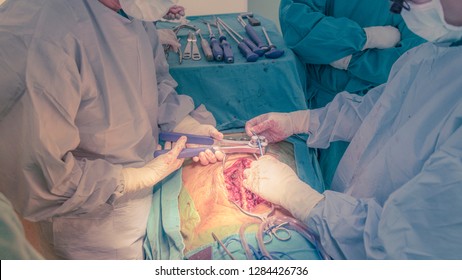 Surgeons Perform Spine Surgery In Modern Operating Room. Doctors Curving The Rod Instrument In Case Of Spinal Fusion.  Low Contrast And Shallow DOF. Medical Concept 