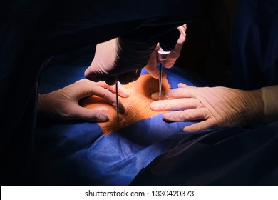 Surgeons Performing Bone Marrow Biopsy