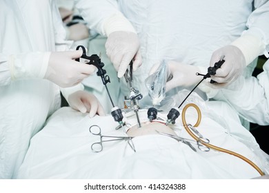 Surgeons Team Hands During Laparoscopic Abdominal Operation In Child Surgery 