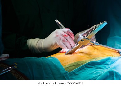 Surgery For Coronary Artery Bypass Grafting: CABG