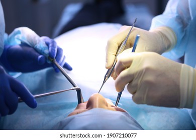 Surgery in a dental clinic. The surgeon and the assistant. Modern dentistry. Photo in the operating room. The concept of healthcare. Hands in protective gloves. People are unrecognizable. 