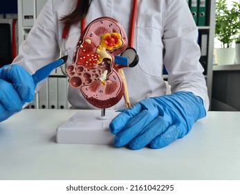Surgery of kidneys and adrenal glands is medical surgical intervention. Doctor holds in one hand model of kidney with ureter and scalpel surgical operation to treat or remove - Shutterstock ID 2161042295