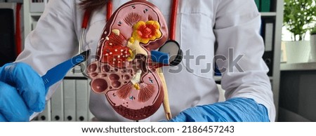 Surgery of kidneys and adrenal glands is medical surgical intervention. Doctor holds in one hand model of kidney with ureter and scalpel surgical operation to treat or remove