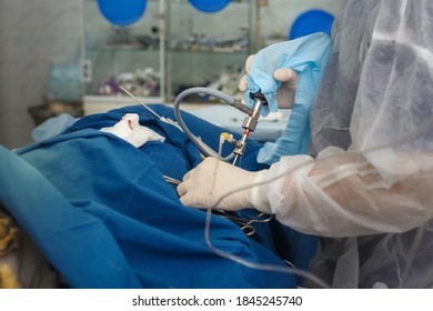 Surgery with multiple punctures and the use of an endoscope - Shutterstock ID 1845245740