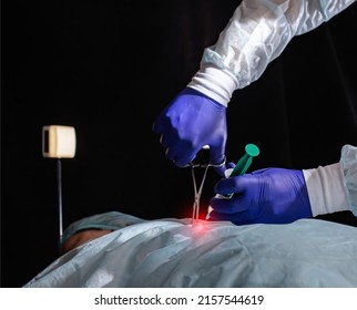 surgery to remove the pancreas and take a biopsy of the patient's liver, close-up. Laparoscopic - Shutterstock ID 2157544619