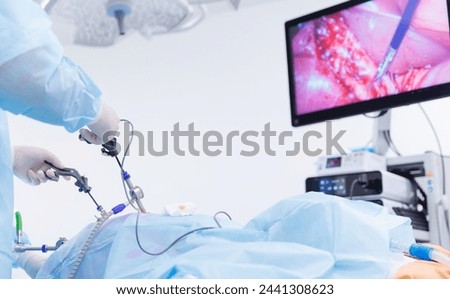 Surgery working with modern laparoscopic equipment camera and lcd screen, sunlight.