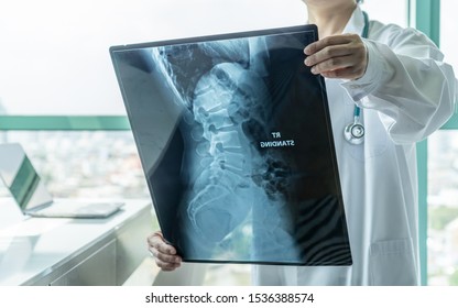 Surgical doctor looking at radiological spinal x-ray film for medical diagnosis on patient’s health on spine disease, bone cancer illness, spinal muscular atrophy, medical healthcare concept - Powered by Shutterstock