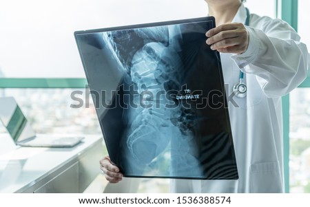 Surgical doctor looking at radiological spinal x-ray film for medical diagnosis on patient’s health on spine disease, bone cancer illness, spinal muscular atrophy, medical healthcare concept