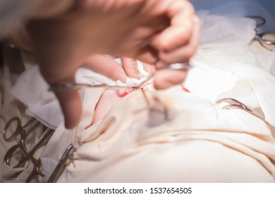 Surgical Instrument In The Hands Of A Surgeon Close-up, With An Unusual Angle. During Surgery In Pediatric Urology