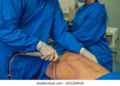 Surgical liposuction tummy tuck plastic