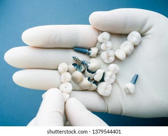 Surgical Orthodontics. Teeth Reconstruction And Prosthodontics. Closeup Of Dentist Hand Holding Ceramic Dental Implants.