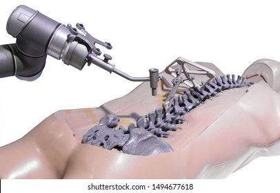 Surgical Robot For Spinal Surgery