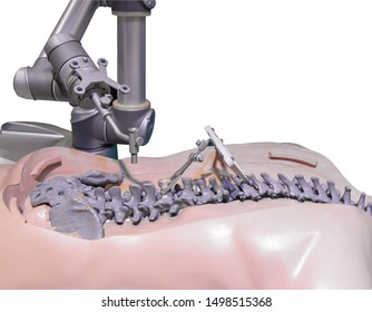 Surgical Robot For Spinal Surgery