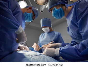 Surgical team in blue medical suits using medical instruments and performing aesthetic surgery in modern clinic. Concept of medicine, abdominoplasty and plastic surgery.