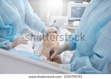 Surgical treatment varicose veins in hospital by team vascular surgeons by Radiofrequency ablation. Surgeon in operating room inserts catheter into vein on patient's lower limb treat varicose veins