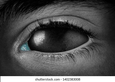 Surreal Scary Close-up Of Zombie Eye With Black Metal Eyeball. Macro. Halloween Theme, Pallid Skin