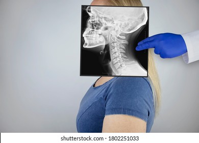 Survey radiography of a woman’s skull and neck on the side. A doctor radiologist is studying an x-ray examination. A snapshot of the skull is placed on the patient’s head.